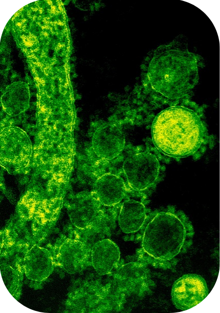 bactéries sous microscope